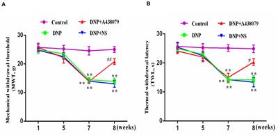 The P2X7 Receptor Is Involved in Diabetic Neuropathic Pain Hypersensitivity Mediated by TRPV1 in the Rat Dorsal Root Ganglion